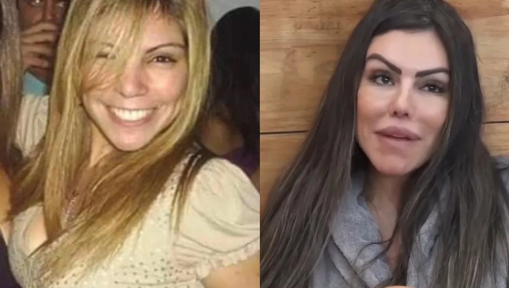 liziane gutierrez antes e depois