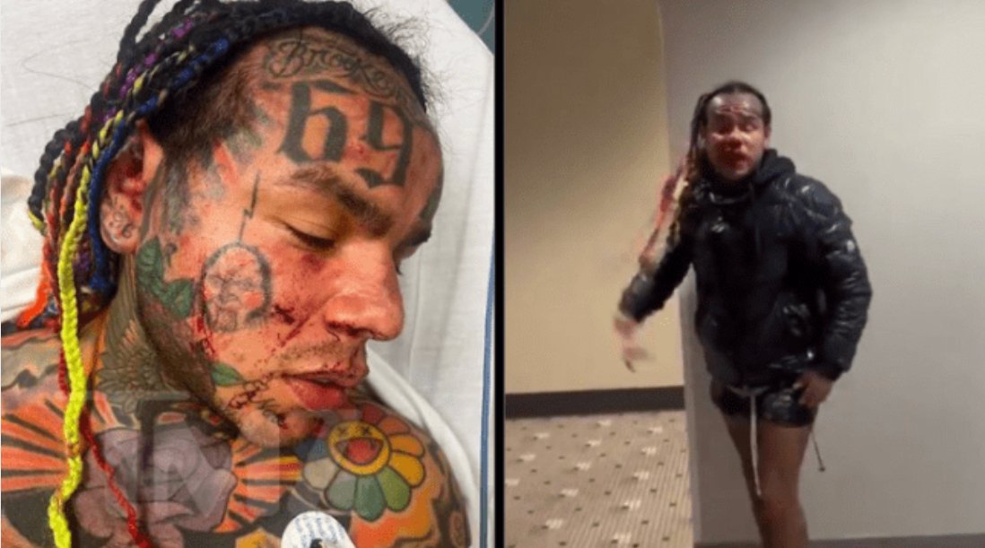 Rapper 6ix9ine é brutalmente espancado durante emboscada na Flórida; veja vídeo