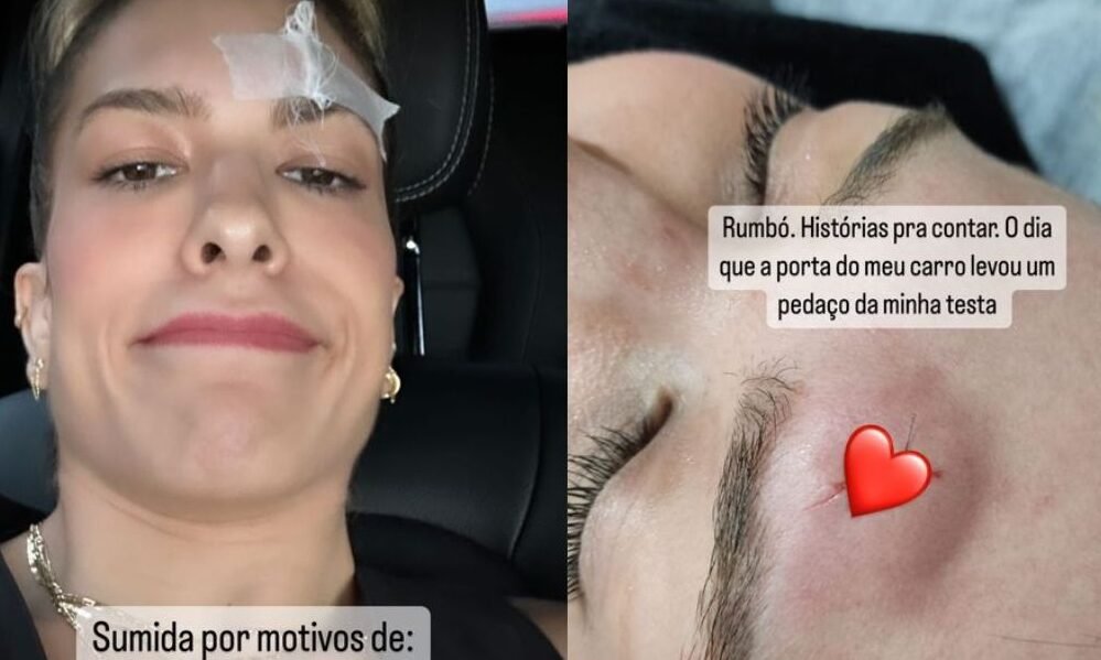 Lore Improta
