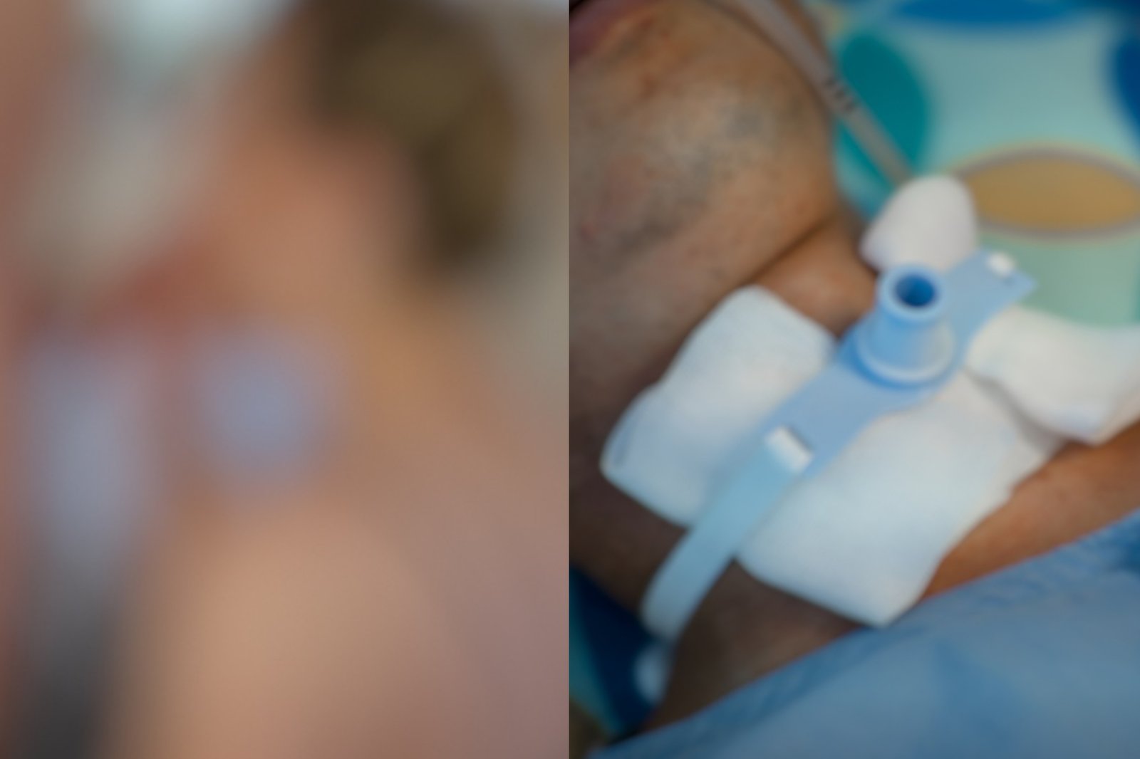 Na Bahia, jovem sofre lesão na traqueia após prática intensa de "amor oral"