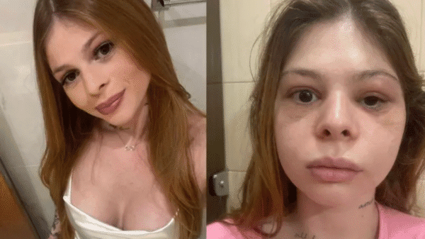 Médica cobre tatuagens feitas por imposição de ex que a espancou: 'Monstro'