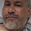 Chrigor, ex-Exaltasamba, se machuca ao tentar separar briga entre pitbulls e é levado ao hospital