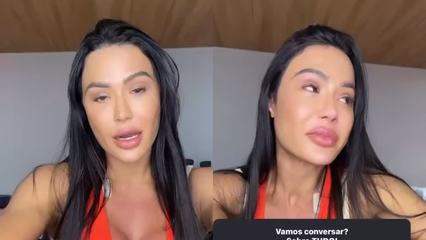 Gracyanne Barbosa chora ao falar de cirurgia após lesão: 'Muita dor'