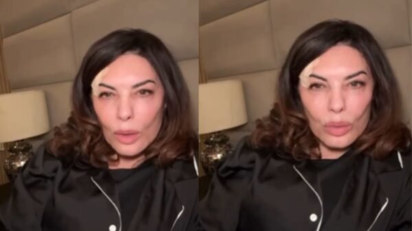 Márcia Goldschmidt detalha recuperação após acidente doméstico e tranquiliza fãs