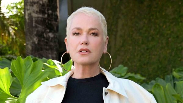 Xuxa mostra resultado de transplante capilar