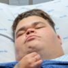 Gordão da XJ passa por cirurgia após perder mais de 130 kg