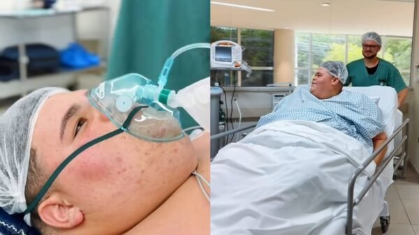 Gordão da XJ passa por cirurgia após eliminar 130 kg: “Mais um passo rumo ao objetivo”