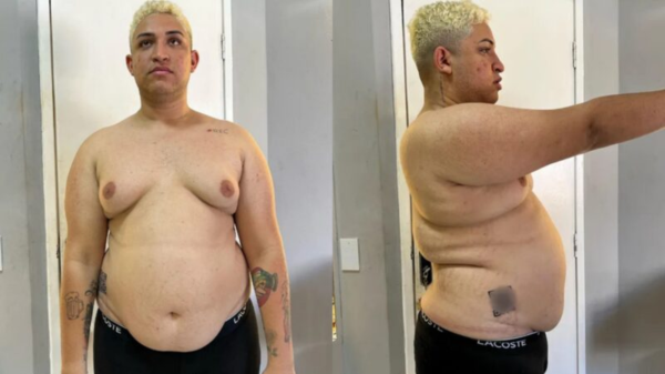 Influenciador vira "padrão" após perder quase 50 kg; veja 11 yarley