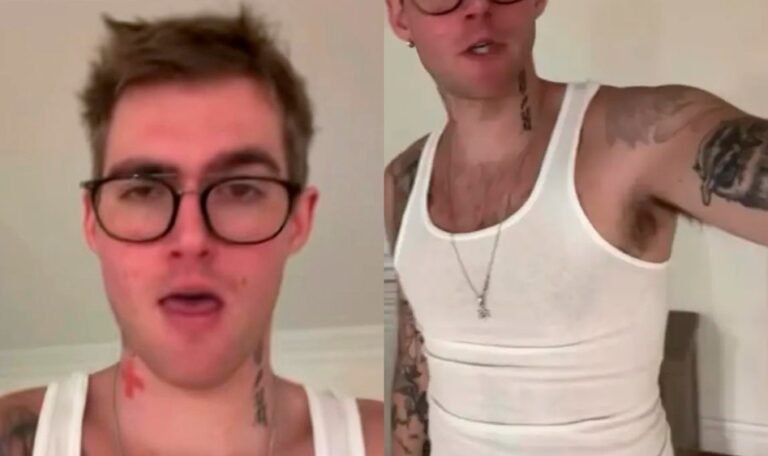 Vídeo mostra Presley Gerber horas antes de morrer em clínica de reabilitação 47 Vídeo mostra Presley Gerber horas antes de morrer em clínica de reabilitação